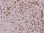 Vimentin Polyclonal Antibody