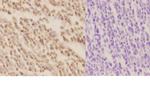 XPA Antibody in Immunohistochemistry (Paraffin) (IHC (P))