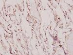 XRCC1 Polyclonal Antibody