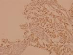 A-Raf Polyclonal Antibody