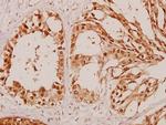beta Arrestin 1 Polyclonal Antibody