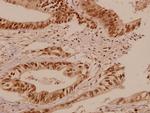 BCR Polyclonal Antibody