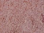 B-Raf Polyclonal Antibody