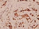GP130 Polyclonal Antibody