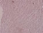 IKK beta Polyclonal Antibody
