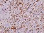 Cytokeratin 8 Polyclonal Antibody