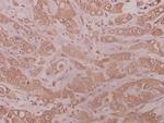 MMP10 Polyclonal Antibody