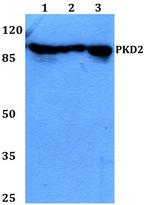 PRKD2 Antibody in Western Blot (WB)