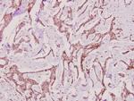 PP2A alpha Polyclonal Antibody