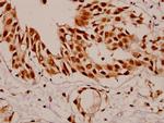 SF1 Antibody in Immunohistochemistry (Paraffin) (IHC (P))