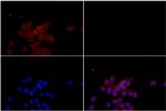 TSC2 Polyclonal Antibody