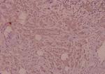 TSC2 Polyclonal Antibody