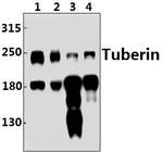 TSC2 Antibody in Western Blot (WB)