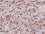 XIAP Polyclonal Antibody