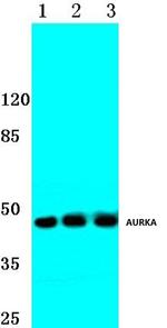 Aurora A Polyclonal Antibody