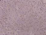 Catalase Polyclonal Antibody