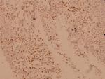 CRYAB Polyclonal Antibody