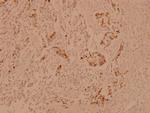CRYAB Polyclonal Antibody