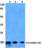 CRYAB Antibody in Western Blot (WB)