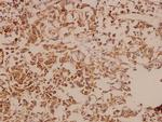 DDX3 Polyclonal Antibody