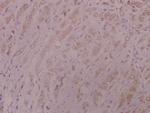 DNA-PK Polyclonal Antibody