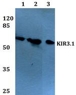 Kir3.1 (KCNJ3) Polyclonal Antibody
