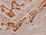 IFNGR1 Polyclonal Antibody