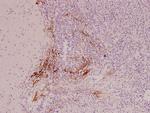 IL9R Antibody in Immunohistochemistry (Paraffin) (IHC (P))