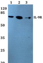 IL9R Antibody in Western Blot (WB)