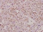 RPA2 Polyclonal Antibody