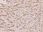 Cystatin A Polyclonal Antibody