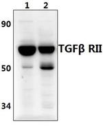 TGFBR2 Antibody in Western Blot (WB)