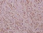 YAP1 Polyclonal Antibody
