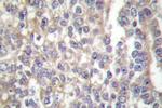 SHC Polyclonal Antibody