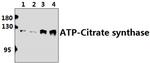 ATP Citrate Lyase Polyclonal Antibody