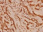 Cdc37 Polyclonal Antibody