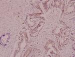 CRYAB Polyclonal Antibody