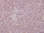 IFNAR1 Polyclonal Antibody
