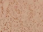PP1 alpha Polyclonal Antibody