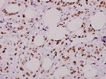 RSK1 Polyclonal Antibody