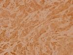 RhoA Polyclonal Antibody