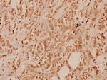 IL13RA1 Polyclonal Antibody
