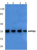 AMPK beta-1 Antibody in Western Blot (WB)