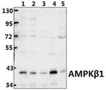 AMPK beta-1 Antibody in Western Blot (WB)