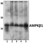 AMPK beta-1 Antibody in Western Blot (WB)