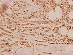 Cytokeratin 18 Antibody in Immunohistochemistry (Paraffin) (IHC (P))