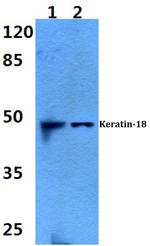 Cytokeratin 18 Antibody in Western Blot (WB)
