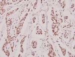MRE11 Polyclonal Antibody