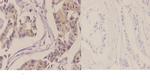 CK2 alpha-1 Polyclonal Antibody