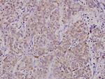 TNFRSF11B Polyclonal Antibody